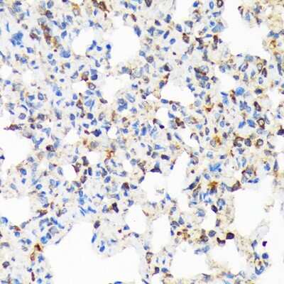 Immunohistochemistry-Paraffin: TIRAP Antibody (9T1A8) [NBP3-16854]