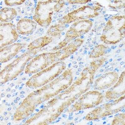 Immunohistochemistry-Paraffin: TIRAP Antibody (9T1A8) [NBP3-16854]