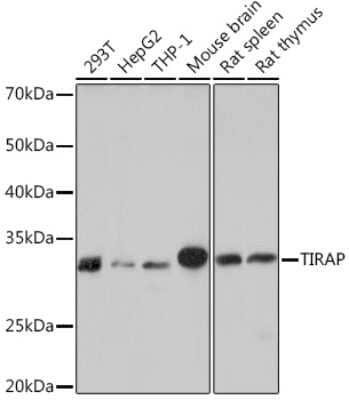 Western Blot: TIRAP Antibody (9T1A8) [NBP3-16854]