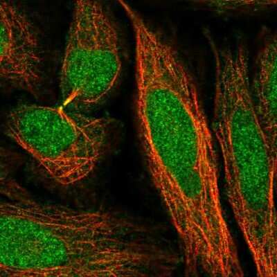 Immunocytochemistry/ Immunofluorescence: TIRAP Antibody [NBP2-47605]