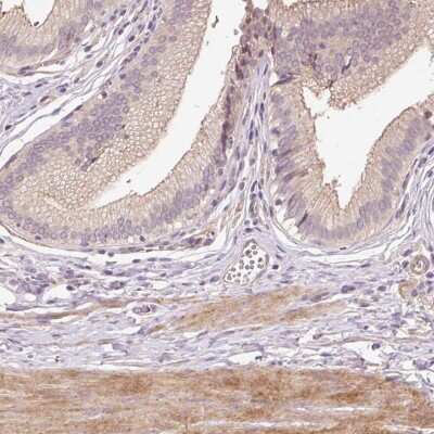Immunohistochemistry-Paraffin: TIRAP Antibody [NBP2-47605]