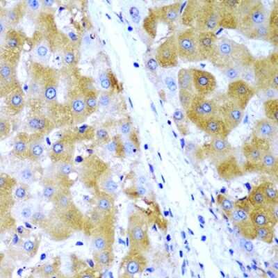 Immunohistochemistry-Paraffin: TIRAP Antibody - BSA Free [NBP3-04543]