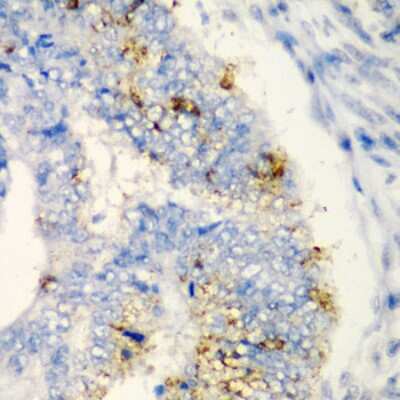 Immunohistochemistry-Paraffin: TIRAP Antibody - BSA Free [NBP3-04543]