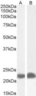 Western Blot: TIRAP Antibody [NB100-2823]