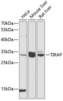 Western Blot: TIRAP AntibodyBSA Free [NBP2-95138]