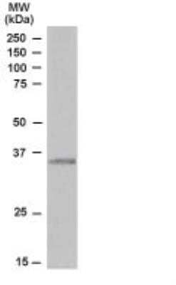 Western Blot: TIRAP Antibody [NB300-990]