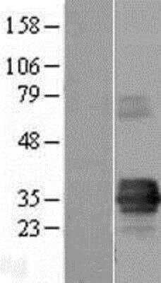 Western Blot: TIRAP (TLR2 and TLR4) Overexpression Lysate [NBP2-08583]