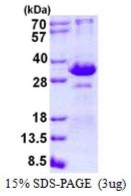 SDS-PAGE: Recombinant Human TIRAP (TLR2 and TLR4) His Protein [NBP2-22871]