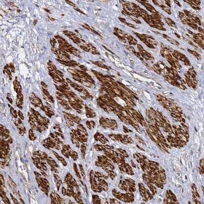 Immunohistochemistry-Paraffin: TIS11D Antibody [NBP1-92510]