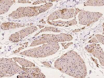 Immunohistochemistry-Paraffin: TIS11D Antibody [NBP2-97954]