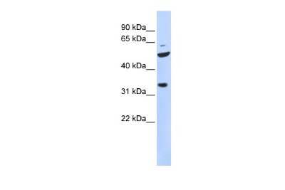 Western Blot: TIS11D Antibody [NBP2-83654]