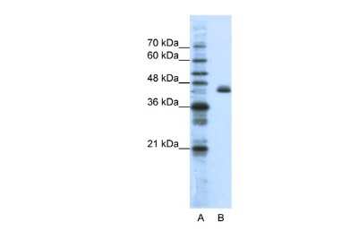 Western Blot: TIS11D Antibody [NBP2-83655]