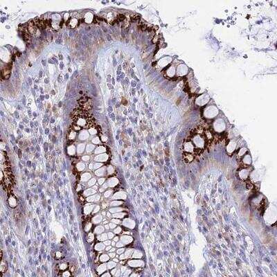 Immunohistochemistry-Paraffin: TISP43 Antibody [NBP1-91208]