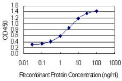 ELISA: TJAP1 Antibody (2E5) [H00093643-M01-100ug]