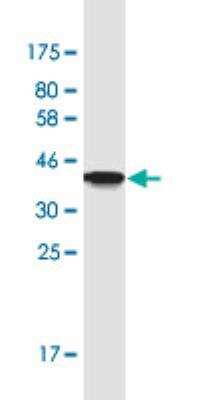 Western Blot: TJAP1 Antibody (2E5) [H00093643-M01-100ug]