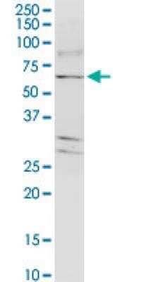 Western Blot: TJAP1 Antibody (2E5) [H00093643-M01-100ug]