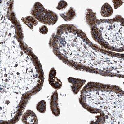 Immunohistochemistry-Paraffin: TJAP1 Antibody [NBP1-80902]