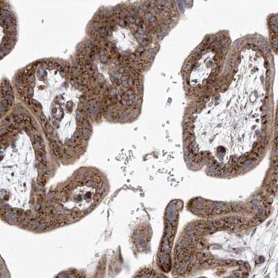 Immunohistochemistry-Paraffin: TJAP1 Antibody [NBP2-38152]