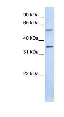 Western Blot: TJAP1 Antibody [NBP1-53200]