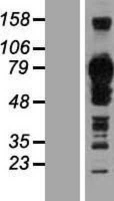 Western Blot: TJAP1 Overexpression Lysate [NBL1-16937]