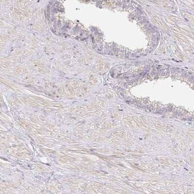 Immunohistochemistry-Paraffin: TJP3 Antibody [NBP2-38696]