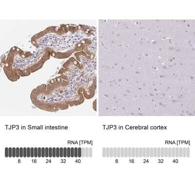Immunohistochemistry-Paraffin: TJP3 Antibody [NBP2-38696]