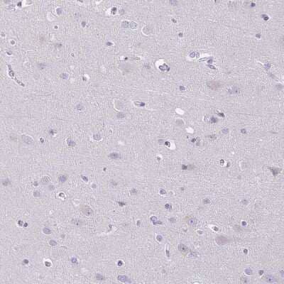 Immunohistochemistry-Paraffin: TJP3 Antibody [NBP2-38696]