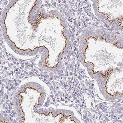 Immunohistochemistry-Paraffin: TJP3 Antibody [NBP2-38696]