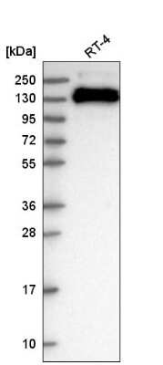 Western Blot: TJP3 Antibody [NBP2-56794]