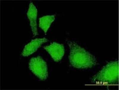 Immunocytochemistry/ Immunofluorescence: TKTL1 Antibody (1C10) [H00008277-M01]