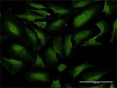 Immunocytochemistry/ Immunofluorescence: TKTL1 Antibody (1D6) [H00008277-M02]