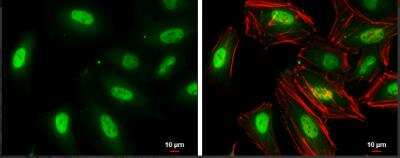 Immunocytochemistry/ Immunofluorescence: TKTL1 Antibody [NBP1-31674]