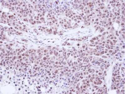 Immunohistochemistry-Paraffin: TKTL1 Antibody [NBP1-31674]