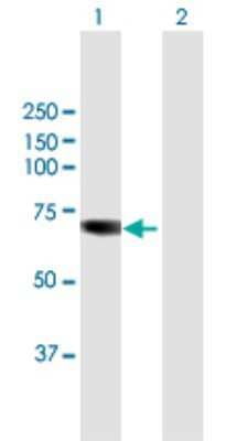 Western Blot: TKTL1 Antibody [H00008277-B01P]