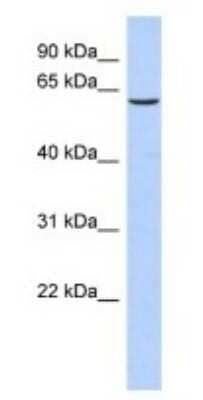 Western Blot: TKTL1 Antibody [NBP1-54864]