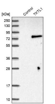 Western Blot: TKTL1 Antibody [NBP1-86939]