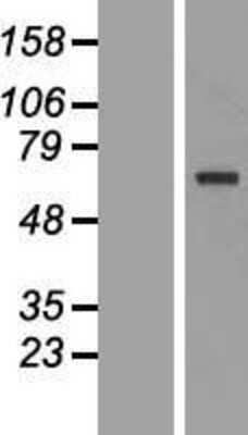 Western Blot: TKTL1 Overexpression Lysate [NBL1-16941]