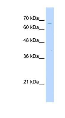 Western Blot: TKTL2 Antibody [NBP1-55173]