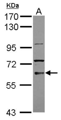 Western Blot: TKTL2 Antibody [NBP2-20649]