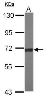 Western Blot: TKTL2 Antibody [NBP2-20650]