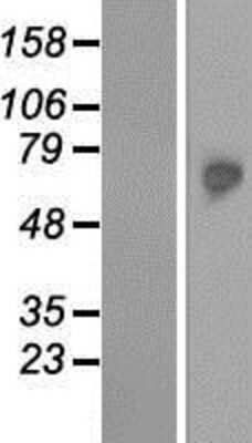 Western Blot: TKTL2 Overexpression Lysate [NBP2-06075]