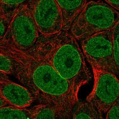 Immunocytochemistry/ Immunofluorescence: TL1A/TNFSF15 Antibody [NBP2-58139]