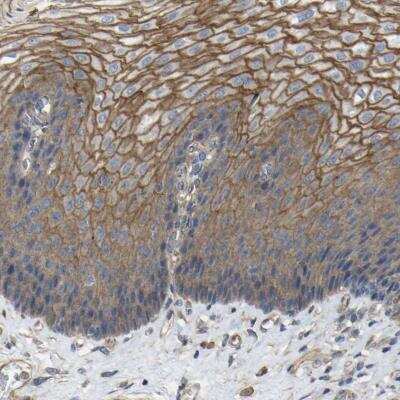 Immunohistochemistry-Paraffin: TL1A/TNFSF15 Antibody [NBP1-82755]