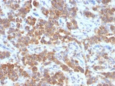 Immunohistochemistry-Paraffin: TL1A/TNFSF15 Antibody (VEGI/1283) [NBP2-53388]