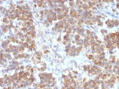 Immunohistochemistry-Paraffin: TL1A/TNFSF15 Antibody (VEGI/2052R) - Azide and BSA Free [NBP3-08802]