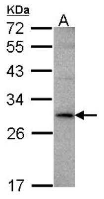 Western Blot: TL1A/TNFSF15 Antibody [NBP1-31159]