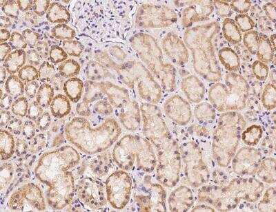 Immunohistochemistry-Paraffin: TLCD1 Antibody [NBP3-06501]