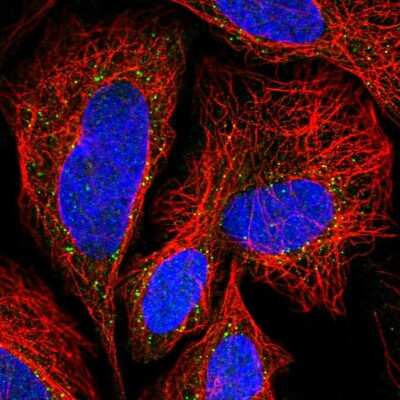 Immunocytochemistry/ Immunofluorescence: TLCD2 Antibody [NBP2-14562]