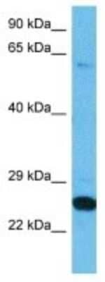 Western Blot: TLCD3A Antibody [NBP3-10054]