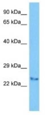 Western Blot: TLCD3A Antibody [NBP3-10084]